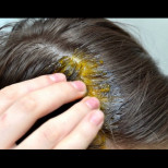 Боли ли ви скалпът при допир? Предупреждение от експертите: Ето какво се случва, когато косата ви "боли".
