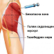 Как се поставя мускулна инжекция-Запазете тази важна информация!