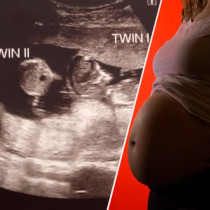 Медицинско чудо! Жена забременя, докато беше бременна - ето резултата (СНИМКИ)
