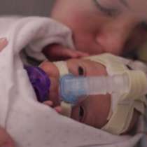 Малкият герой, който се роди 15 седмици преди термина, разплака милиони - Видео 