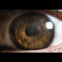 Как очите разкриват в какво състояние е мозъкът ви