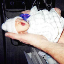 Ето как изглежда 20 години по-късно бебето, което се роди едва 900 грама-Снимки и видео
