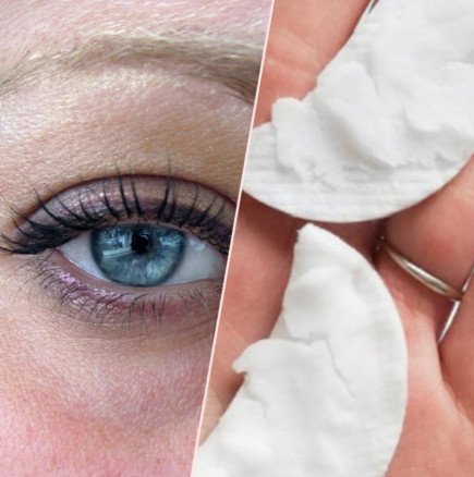 Това е най-евтиният начин за премахване на тъмните кръгове: Смес от 2 съставки стяга кожата около очите по-добре от всеки крем