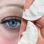 Това е най-евтиният начин за премахване на тъмните кръгове: Смес от 2 съставки стяга кожата около очите по-добре от всеки крем