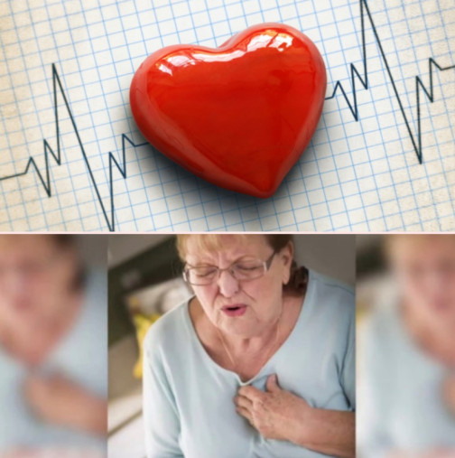 Този симптом на инфаркт се появява месеци по-рано, без да го отдаваме на тази диагноза