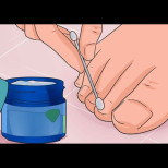 Тези 6 мощни лека ще премахнат и най-пренебрегваните гъбички по ноктите