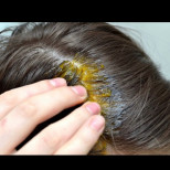 Предупреждение от експертите: Ето какво се случва, когато косата ви "боли".