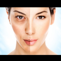 Според вида на стареене на кожата: 5 процедури, които ще заличат бръчките от лицето ви