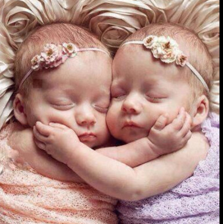 Ето как изглеждат днес близначките, известни от снимката- Прегръдката, която спаси живот