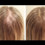Незабавни резултати-Нанесете тези 6 съставки върху косата си и тя ще расте гъста