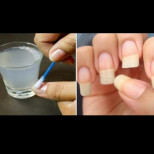 Как бързо да ви пораснат нокти, които никога няма да се счупят: Просто лекарство с 4 съставки ще ви помогне