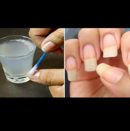 Как бързо да ви пораснат нокти, които никога няма да се счупят: Просто лекарство с 4 съставки ще ви помогне