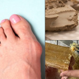 Глина + сапун = Лек №1 при деформирано кокалче на крака (РЕЦЕПТА)