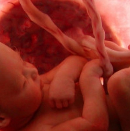 Ужаси в клиника за аборти: Намерени органи на 40 бебета и фетуси