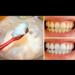 Добавяте това върху четката за зъби и ги измивате-За 2 минути ще са по-бели!