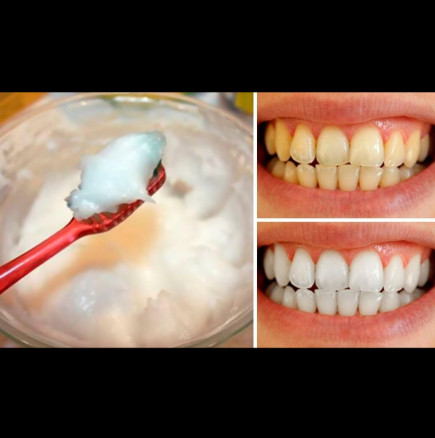 Добавяте това върху четката за зъби и ги измивате-За 2 минути ще са по-бели!