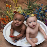 Удивителните близнаци с различен цвят на кожата и техните родители-Ето как изглеждат днес-Снимки