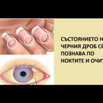 Очи и нокти: Огледало на състоянието на ЧЕРНИЯ ДРОБ и ЖЛЪЧКАТА