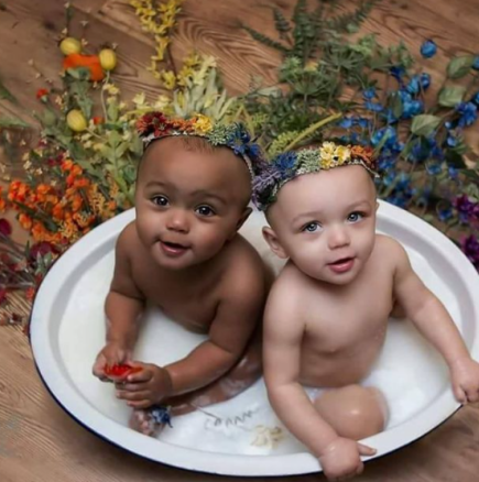 Удивителните близнаци с различен цвят на кожата и техните родители-Ето как изглеждат днес-Снимки