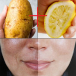 1 картоф + 1 лимон = сбогом бръчки и петна! 100% натурална маска: