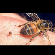 Когато сте ужилени от оса, стършел или пчела: Това ще ви спести болка и подуване
