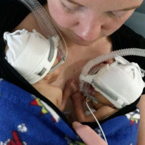 Жена роди близнаци, но малко по-късно премина през голям кошмар