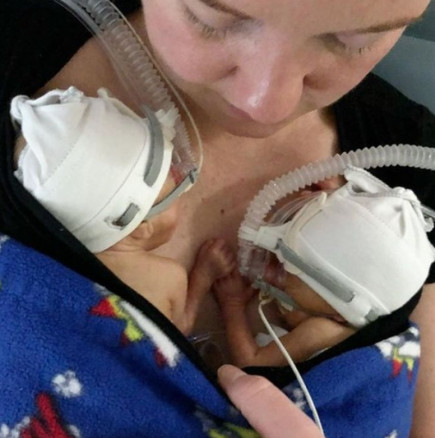 Жена роди близнаци, но малко по-късно премина през голям кошмар