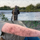 Методът на рибарите: Ето как значи се пазят от комарите! Не струва и стотинка, расте в природата: