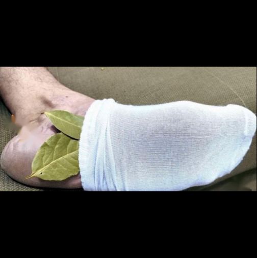1 дафинов лист в чорапа и забравяш що е то болка! Родих се с този метод: