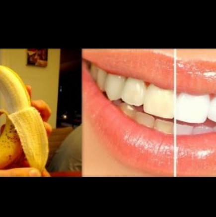 Избелете зъбите с банан-100% ефективно и проверено!