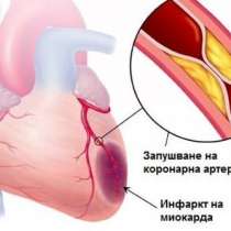 Лекарството, което предпазва от инфаркт и инсулт