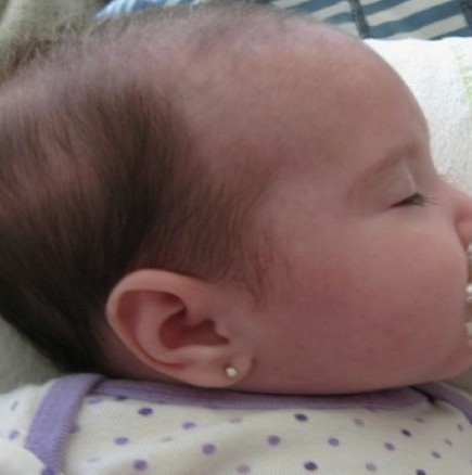Възпаление на ушите при бебета