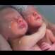 Близнаци не знаят че са се родили - Видео
