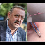Проф. Кантарджиев посъветва: Ето как се маха правилно кърлеж, всички трябва да се научат