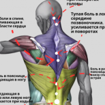 Карта на болките в гърба: Какво ви казва тялото, когато ви боли вратът, долната част на гърба