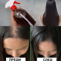 Ефектът е поразителен! Домашен лек против косопад и олисяване - новата коса расте по-гъста, по-лъскава, по-здрава: