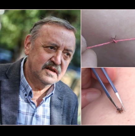 Проф. Кантарджиев посъветва: Ето как се маха правилно кърлеж, всички трябва да се научат