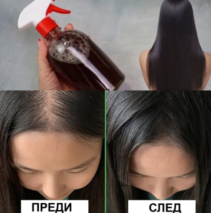 Ефектът е поразителен! Домашен лек против косопад и олисяване - новата коса расте по-гъста, по-лъскава, по-здрава: