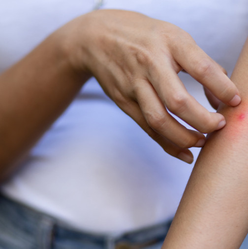 Мариса (28) победи рак на гърдата, след което почина от ухапване от насекомо: Лекарите не я взеха на сериозно и сега плачат от мъка!