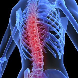 Кои са причините за остеопорозата