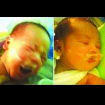 В болница залепиха с тиксо устата на бебе, за да не плаче