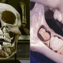 Ето как изглеждат постоянните ни зъби, преди да са паднали млечните