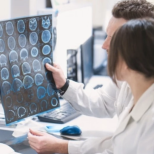 Това е свързано с очите: Трае по-малко от 24 часа и е сигурен знак, че предстои тежък инсулт