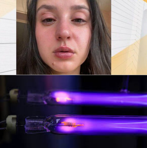 Престъпна небрежност в столична болница: Майка и бебето й с изгаряния на очите от UV лампа