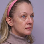 Забременях на 44 години, тъй като бях самотна жена. Сега не знам какво да правя по въпроса, а съм вече и баба