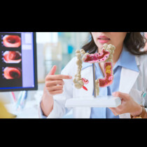 Това са 5 храни, които никой лекар няма да докосне заради риск от рак на дебелото черво