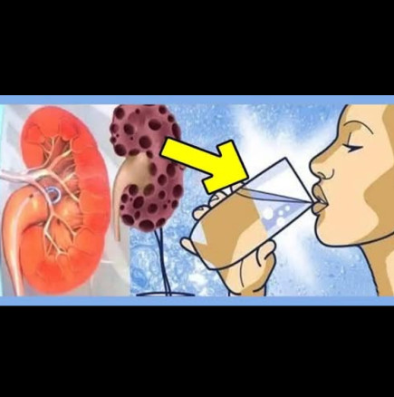 Тези 8 неща УНИЩОЖАВАТ БЪБРЕЦИТЕ ВИ! Обзалагаме се, че правите №7! Рецепта за здравословна напитка, която ще ги излекува: