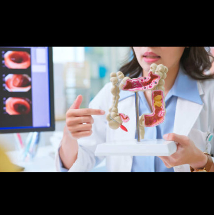 Това са 5 храни, които никой лекар няма да докосне заради риск от рак на дебелото черво