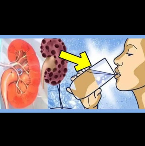 Тези 8 неща УНИЩОЖАВАТ БЪБРЕЦИТЕ ВИ! Обзалагаме се, че правите №7! Рецепта за здравословна напитка, която ще ги излекува: