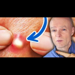 Лекар предупреждава: Това са 10 ЯСНИ признака, че ядете твърде много захар. Малко хора ги забелязват!